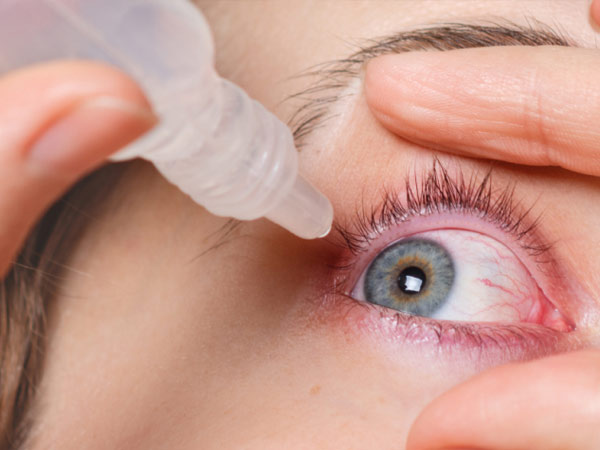 Синдром сухого глаза – заболевание, к которому стоит отнестись серьезно