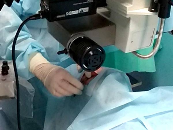Одна из тысяч операций коррекции зрения в Госпитале Исманкулова