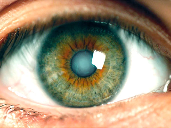 Глаукома – тихий убийца зрения